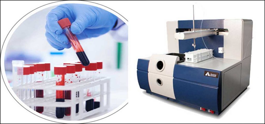 آنالیز فلزات سنگین خون با دستگاه جذب اتمی